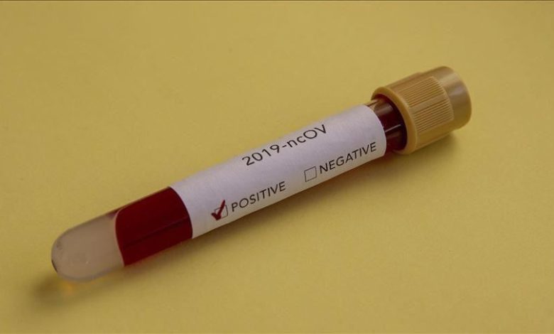 ان دونوں انسٹی ٹیوٹ میں سرگرم مقدمات کی تعداد دو ہندسوں میں ہے