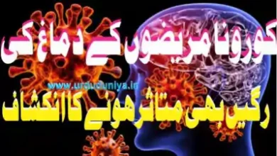 covid brain arteries affected