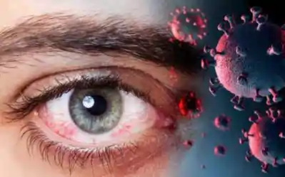 black fungus symptoms prevention treatment