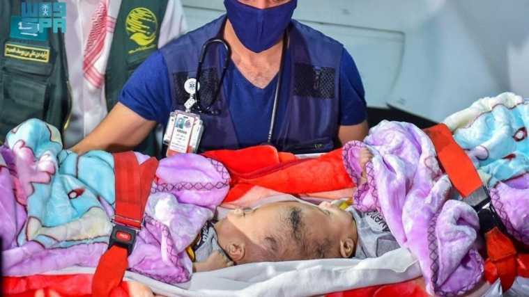 یمنی جڑے بچے