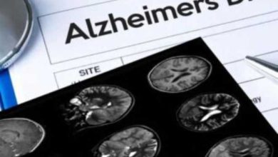drug to treat Alzheimer's