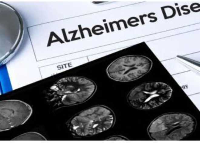 drug to treat Alzheimer's