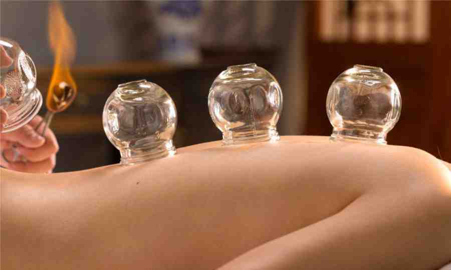 Benefits of Cupping-حجامہ