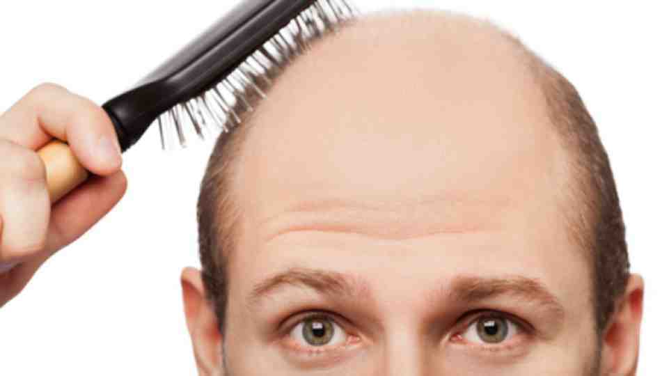 cure for baldness