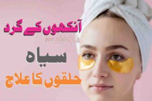 treatment-of-dark-circles-around-the-eyes