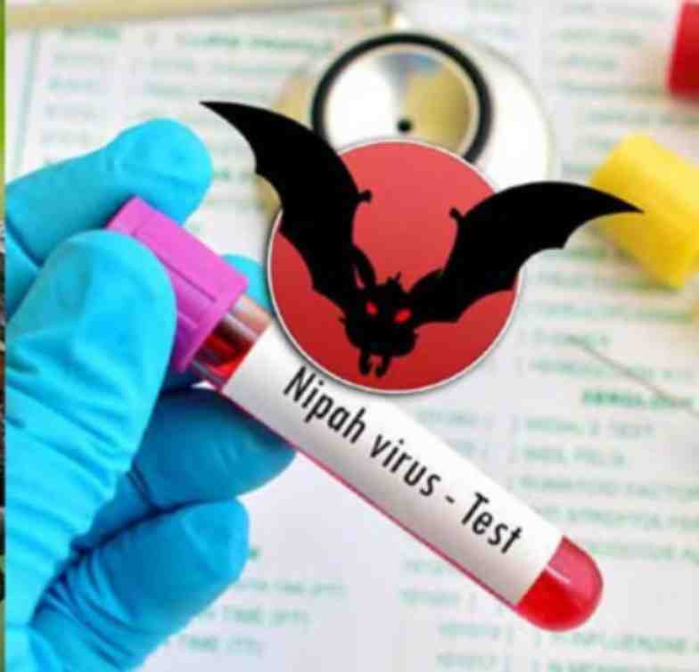 Nipah virus