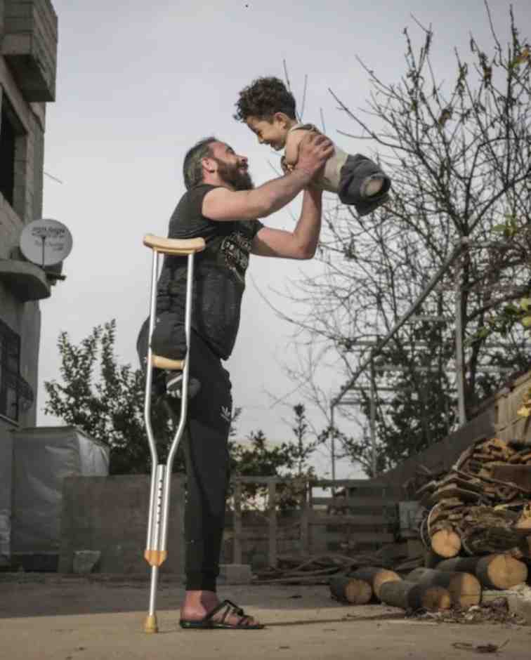 photo-of-father-and-son-who-lost-their-limbs-due-to-syria-civil-war-wins-prize
