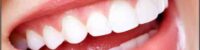 research-nanozyme-therapy-to-protect-teeth