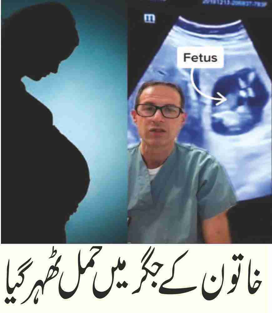the-pregnancy-found-in-the-woman-liver