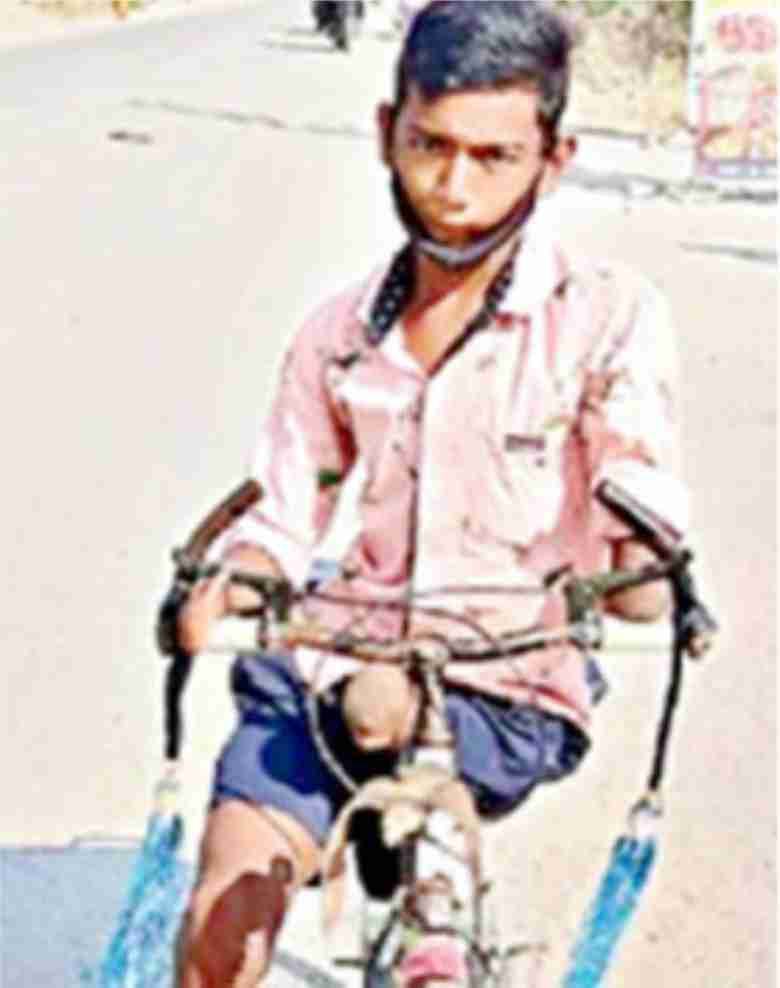 Student with both hands and one leg disabled