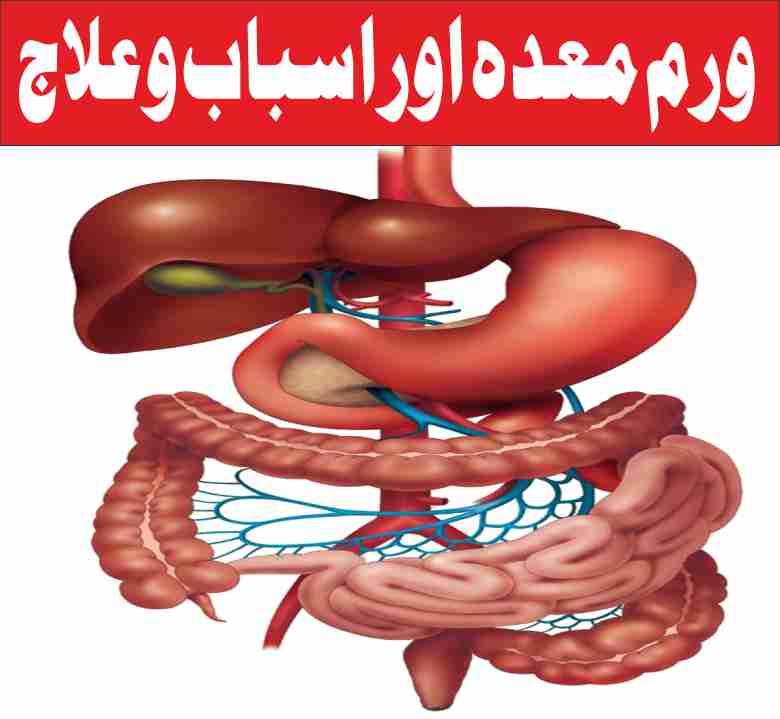 inflammation-of-the-stomach-and-its-causes-and-treatment
