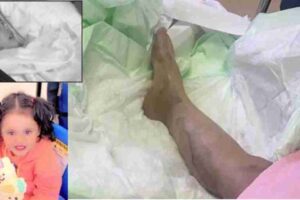 jeddah-horrific-details-of-wife-burning-with-acid