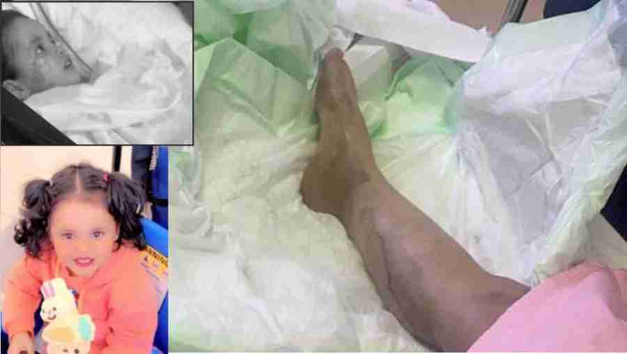 jeddah-horrific-details-of-wife-burning-with-acid