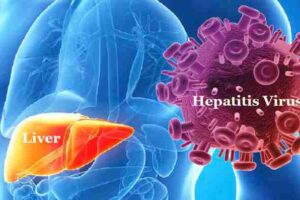 LIVER-HEAPATITIS