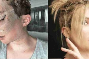 for-fame-on-social-media-the-young-man-became-a-beautiful-girl-through-plastic-surgery