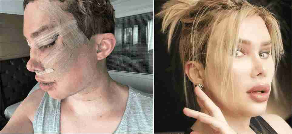 for-fame-on-social-media-the-young-man-became-a-beautiful-girl-through-plastic-surgery
