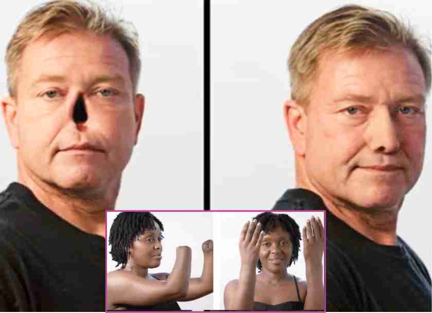 health-news-update-take-the-artificial-nose-eye-and-ear-from-this-hospital