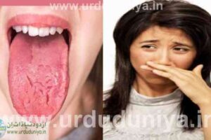 bad breath causes tongue cracking and bad breath