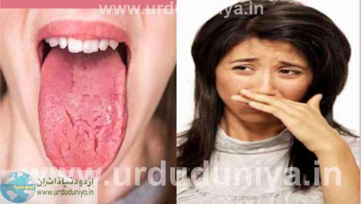 bad breath causes tongue cracking and bad breath