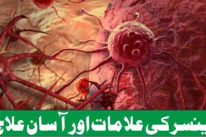 cancer symptoms and easy treatment