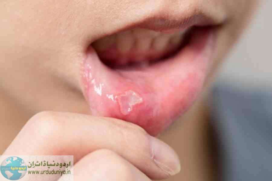 causes of mouth sores and inflammation