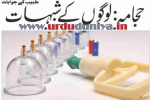 حجامہ hijama