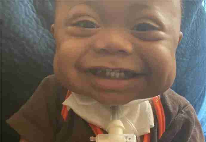 a saudi surgeon saved a baby born with a rare heart defect from surgery