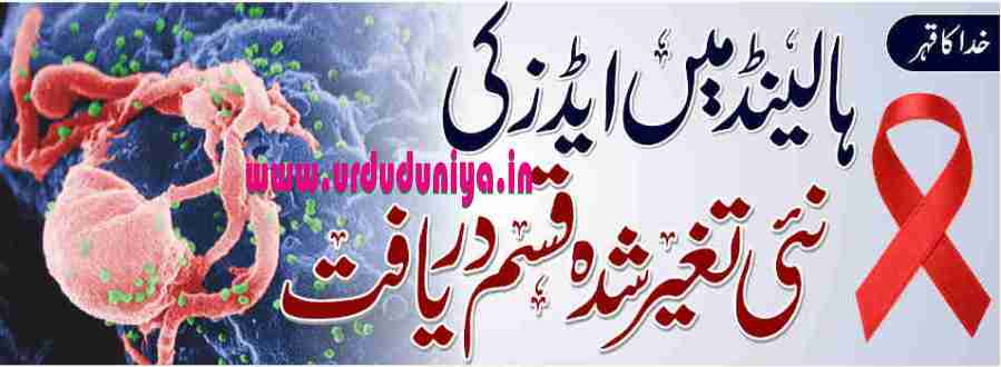 new aids highly virulent hiv strain in the netherland