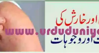 scabies symptoms treatment