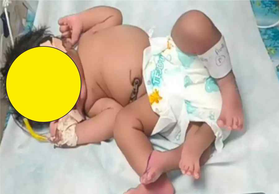 gwalior woman gives birth to baby girl with 4 legs