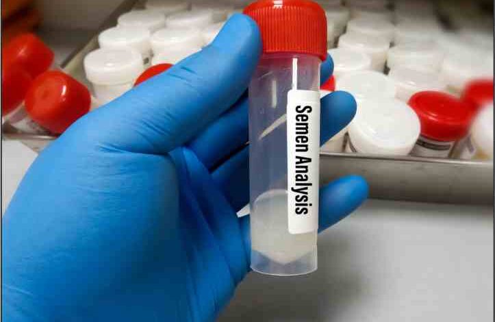 sperms