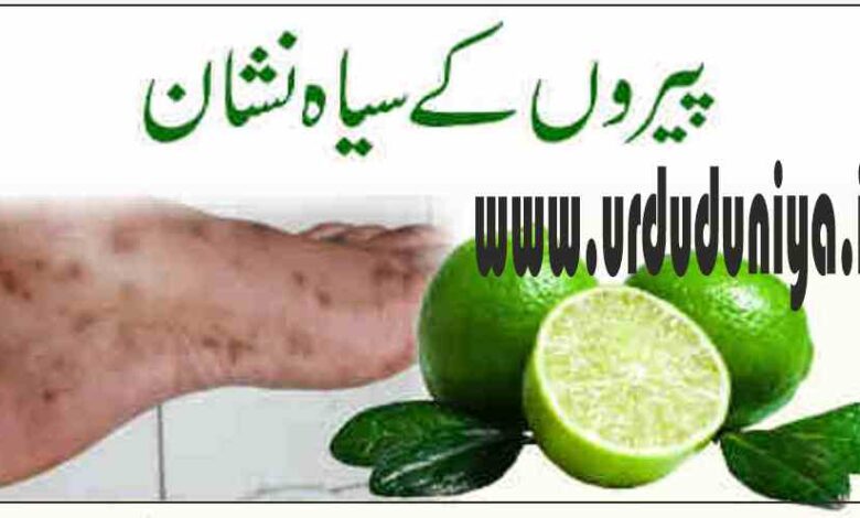 dark spots on your legs