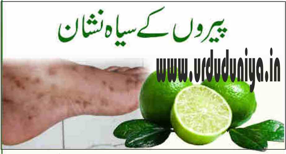 dark spots on your legs