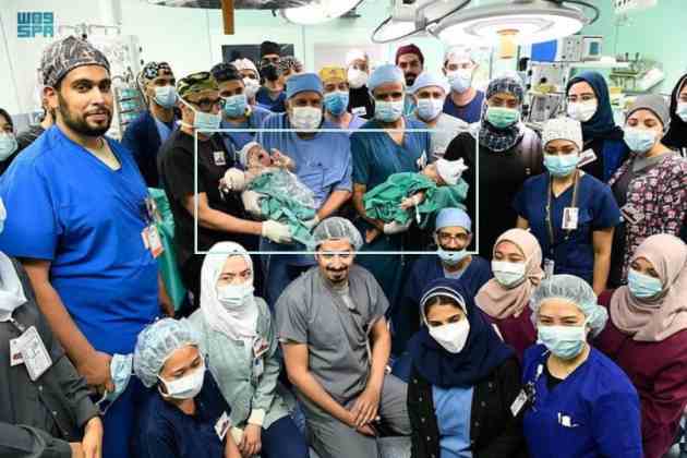 two iraqi conjoined twins in saudi arabia were successfully separated