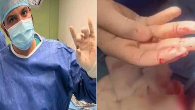 a blind bullet hit the head of the kuwaiti child in the house
