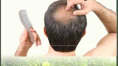 baldness treatment