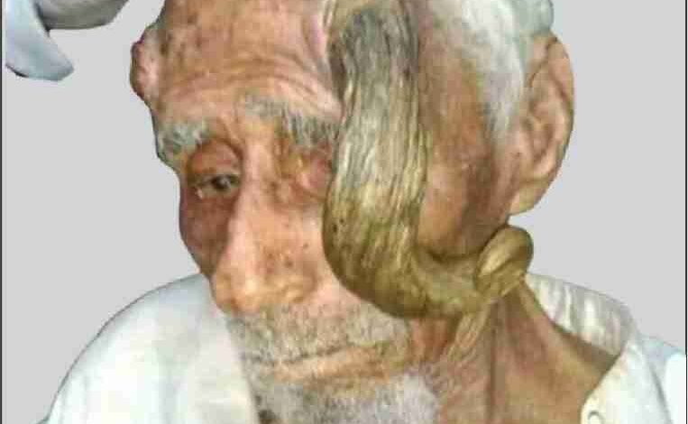 a yemeni man with two horns pass away