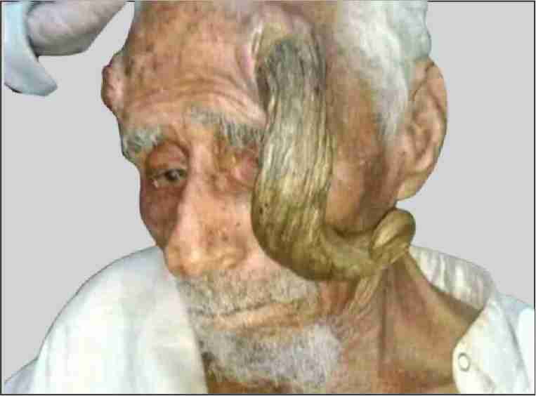 a yemeni man with two horns pass away