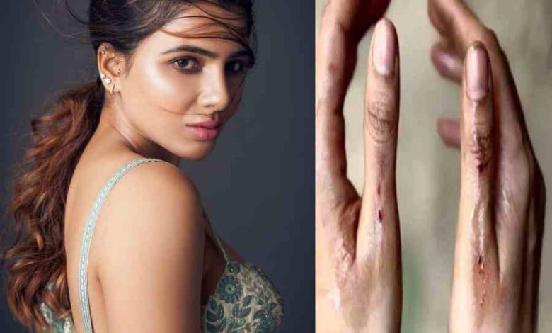 actress samantha got injured during the shooting of the film