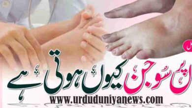 is swelling of the feet serious