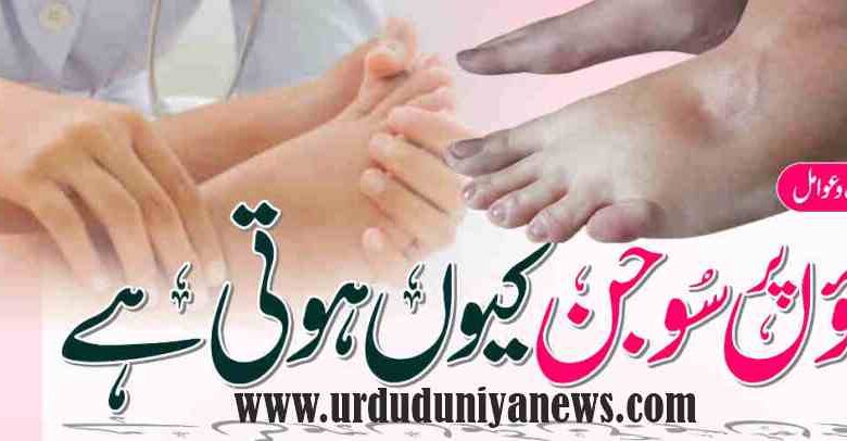 is swelling of the feet serious
