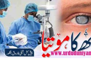 cataract of the eye