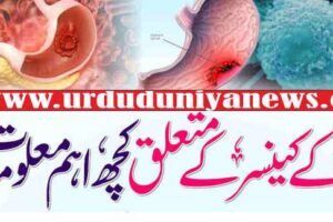 gastric cancer