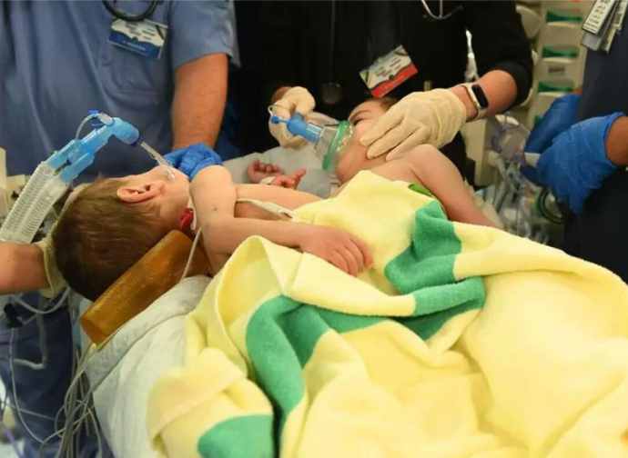 saudi medical team surgery to separate conjoined syrian twins