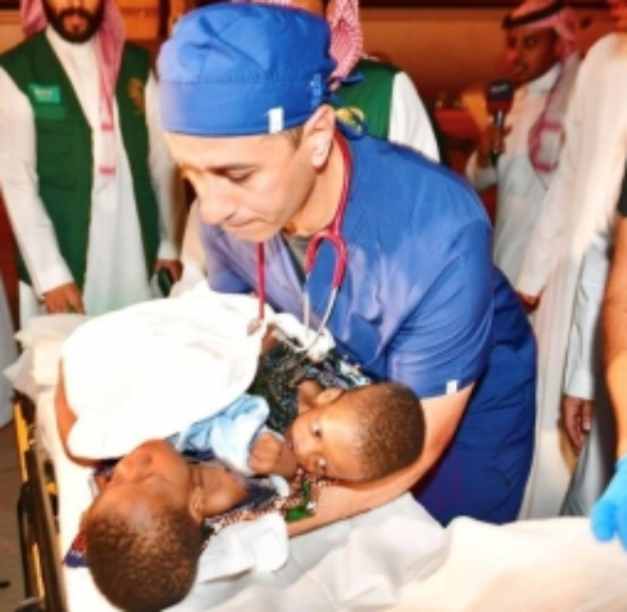 tanzanian siamese twins hasan and hussain reached riyadh for separation