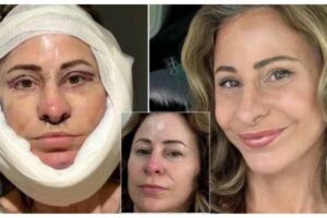 the woman sold her house to get cosmetic surgery