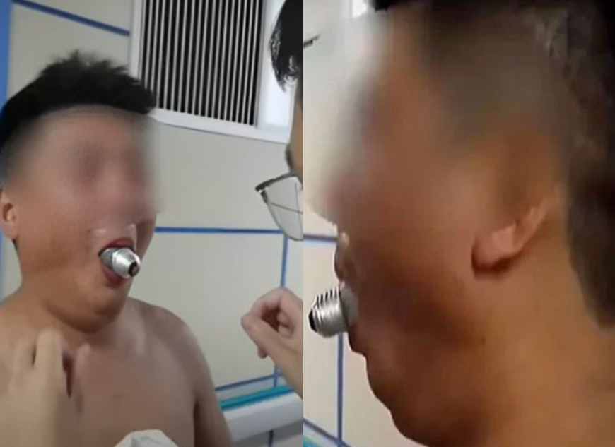 a chinese citizen was caught in an online challenge and got stuck in the mouth