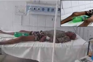bihar news hospital uses cold drink bottle instead of urine bag