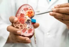 kidney failure warning signs