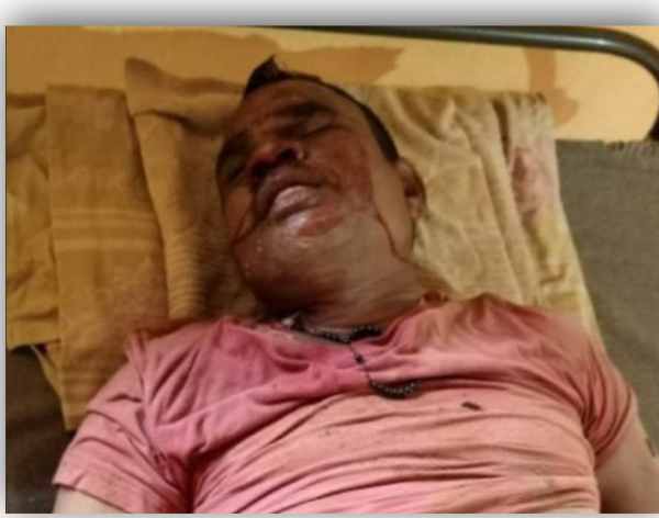 naxalites shot retired jawan